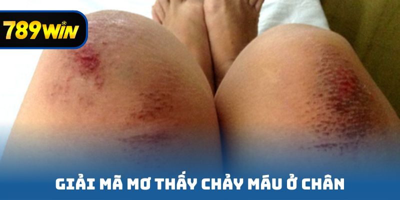 Giải mã mơ thấy chảy máu ở chân