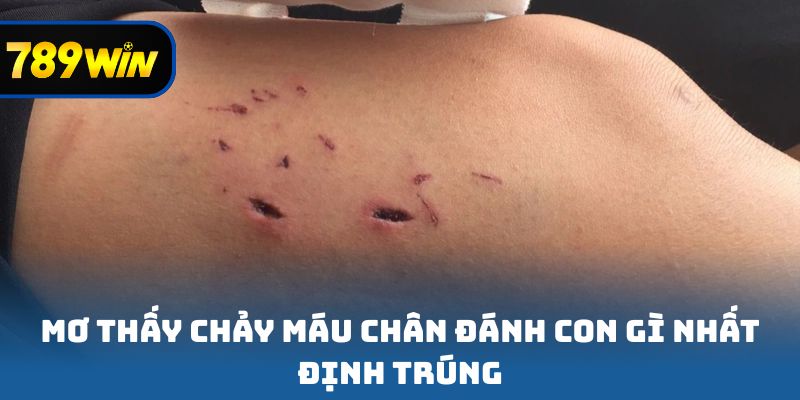 Mơ thấy chảy máu chân đánh con gì nhất định trúng